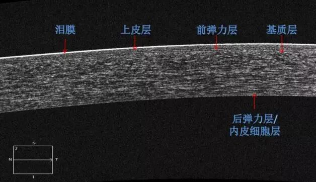 8868体育课堂：后节频域OCT前节模块的运用2.jpg