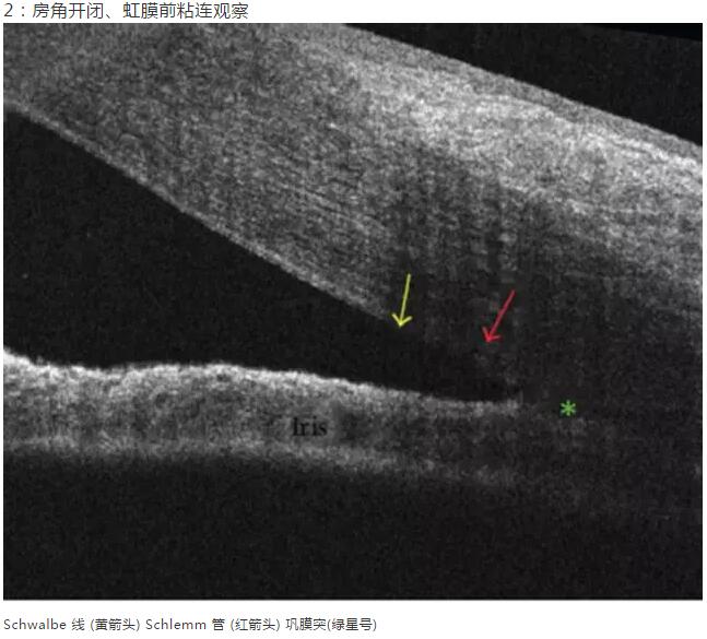 8868体育课堂：后节频域OCT前节模块的运用12.jpg