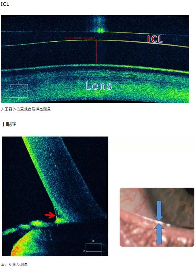 8868体育课堂：后节频域OCT前节模块的运用15.jpg