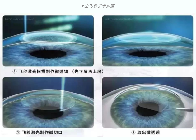 7月26日来深圳8868 - 看球聊球追世界杯就来8868体育有限公司官方网站参与暑期摘镜季活动就可以有机会参与抽奖免单手术！2.png