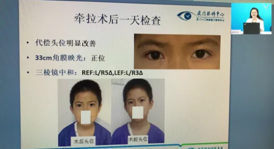 高峰论道·云端荟萃 ▏万人同步在线，30余名大咖云集“第六届8868体育论坛斜视与小儿眼科新技术学习班暨小儿、眼视光分论坛”7.png
